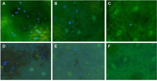 감귤검은점무늬병균을 접종한 감귤 잎의 현광현미경 사진. 감귤 잎에 살균수 (A, D), 길항근권세균 TRH423-3 처리 (B, E) 또는 디티아논 (C, F) 처리한 후 감귤검은점무늬병균을 접종한 후 (1일째, 7일째) 모습. 길항근권세균 농도는 1 x 106cfu/ml이고 디티아논은 1g/L농도로 처리