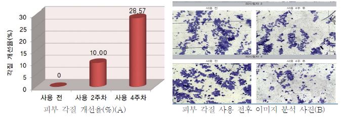 제품적용 전후 피부 각질 개선 및 이미지 분석