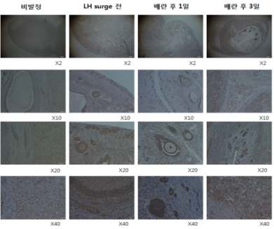 조직면역염색에 의한 난소 내 Androgen Receptor 발현 분석