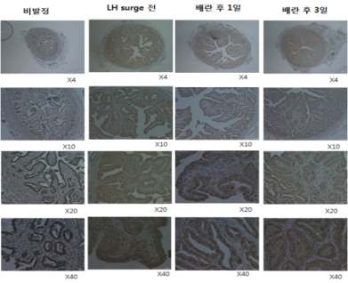 조직면역염색에 의한 난관 내 Estrogen Receptor-Beta 발현 분석