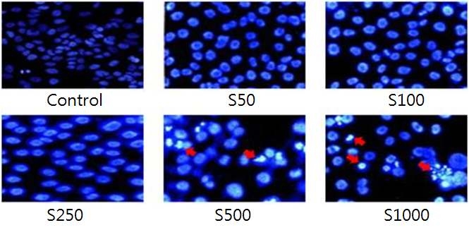 실크단백질 처리 MCF-7 세포의 형광현미경 사진