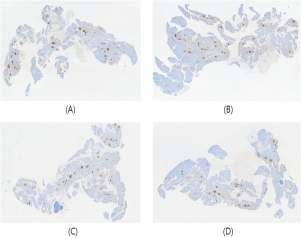 (A) Control, (B) MBE, (C) MBT, (D) Metformin: IHC 면역염색(인슐린 항체 붙임) 각 췌장의 전체 형태 20배 촬영 사진.