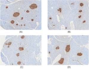 (A) Control, (B) MBE, (C) MBT, (D) Metformin: IHC 면역염색(인슐린 항체 붙임) 각 췌장의 100배 촬영 사진.