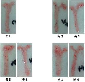 60% H igh fat diet 섭취와 함께 M BE , M BT를 4주간 경구투여한 K K -A y mice의 심장 aorta 조직의 O il red-O 염색 사진.