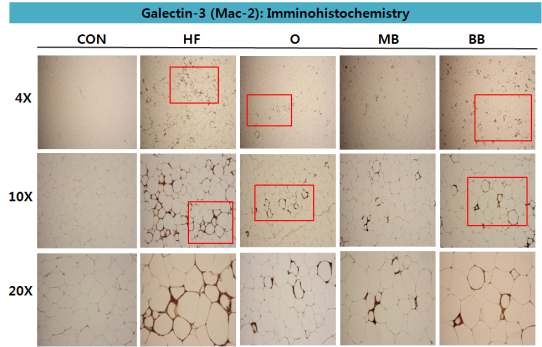 45% fat-DIO C57BL/6 mice에서의 녹두와 검정콩 추출물이 부고환지방에서의 Galetin-3(Mac-2) immunochemistry 결과