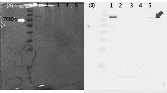 Agroinfiltration후 total protein에 대한 SDS-PAGE(A) and Immunodetection(B) 확인