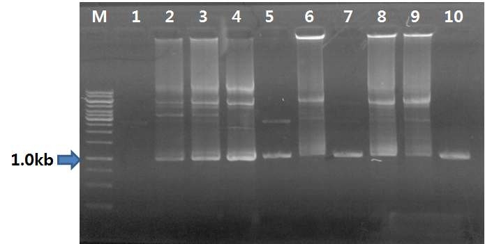 pRTL2-LfB-N 라이브러리 PCR analysis