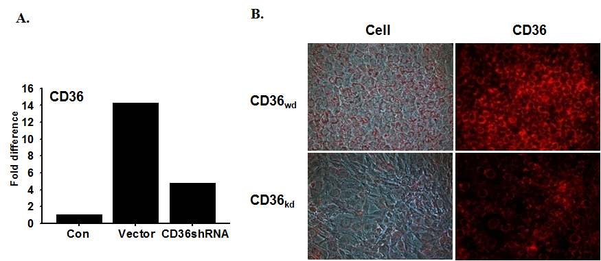 C2C12 세포의 이형분화와 CD36 knock-down에 따른 이형분화 관찰