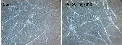 배양 10일 근육줄기세포에 50 ng/ml의 T4를 처리하고 6일 동안 배양한 세포의 모습이다