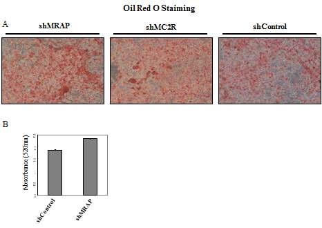 shRNA를 이용하여 Mrap과 MC2R의 발현을 억제시킨 세포에서 지방축적률 조사