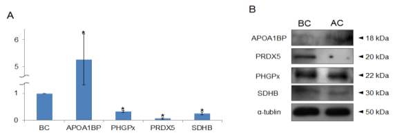 Proteins level of APOA1BP, PRDX5, PHGPx and SDHB by Western Blotting.