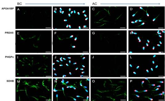 Localization and expression of APOP1BP, PRDX5, PHGPx, and SDHB before-and after-capacitation in porcine spermatozoa.