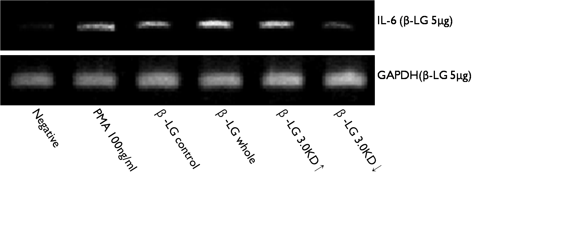 HMC-1 cell에 α-Lactoglobulin을 5μg 처리하였을 때 발현되는 IL-6.