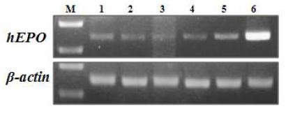 hEPO 형질전환 돼지 장기별 hEPO mRNA 발현 (RT-PCR)hEPO mRNA는 각각의 장기에서 발현되고 있음.