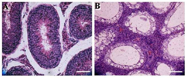 hEPO 형질전환돼지의 정소 발육(A) 일반돼지, (B) hEPO 형질전환돼지