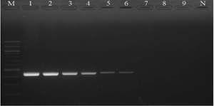 Sensitivity of PCR assay for S. maltophilia. Lane 1 to 9; 10-fold dilution of genomic DNA of S. maltophilia (500 ng to 5 fg). Detection limit of the PCR was 5 pg of the genomic DNA .