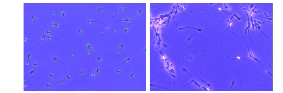 Normal (left, Control) and agglutinated (right, T3) images in semen samples captured from a CASA(Computer-Assisted Semen Analysis, Medical Supply, Korea) video monitor