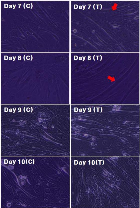 T.peptide (EVPEVHEEVH) 처리에 따른 세포 morphology 변화