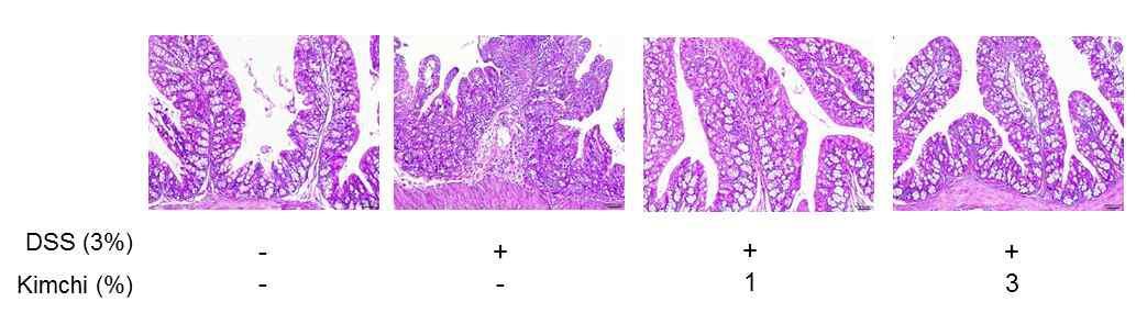 Histologic finding of distal colon of DSS-induced experimental colitis treated with kimchi