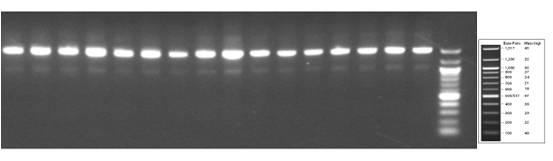 16S rRNA 유전자 증폭을 위한 PCR product