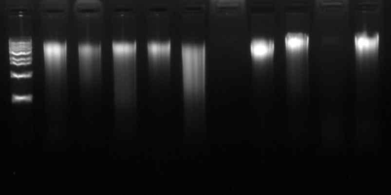 분변샘플내 미생물 genomic DNA
