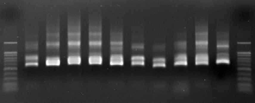 각 분변시료의 바코드 PCR결과