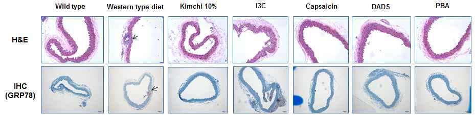 H&E staining and IHC(GRP78) in the aorta of ER stress markers in the aorta of mice fed Kimchi and its main active components at 12 weeks.