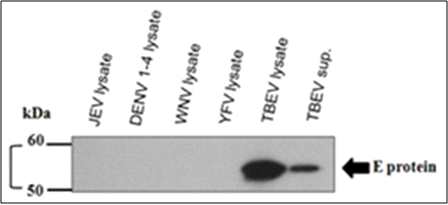SDS-PAGE of protein from Drosophila S2 cells transfected with pMT/JEV/PrM-E, pMT/DEN2/PrM-E, pMT/WNV/PrM-E, pMT/TBEV/PrM-E, and pMT/YFV/PrM-E