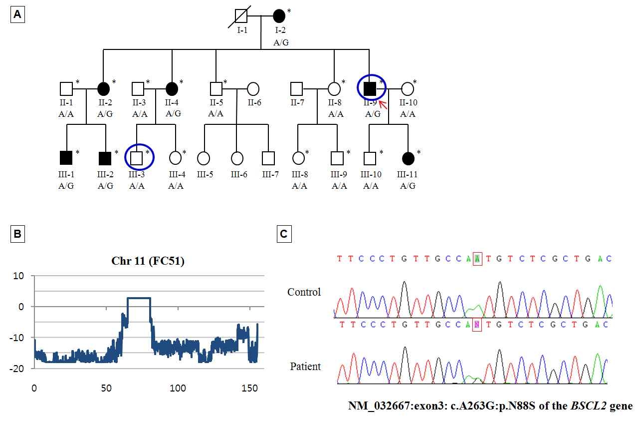 FC51 가족의 pedigree (A), 연관 분석 (B), 환자-정상인의 sequence traces (C)