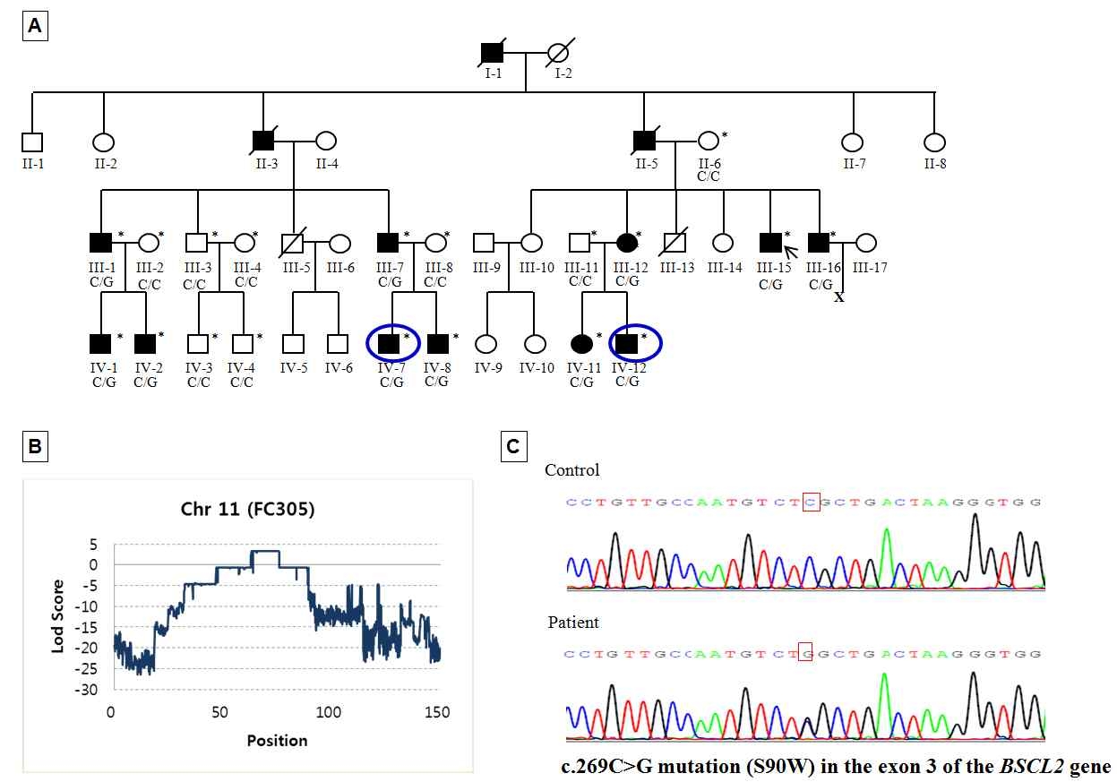 FC305 가족의 pedigree(A), 연관 분석(B), 환자-정상인의 sequence traces(C)