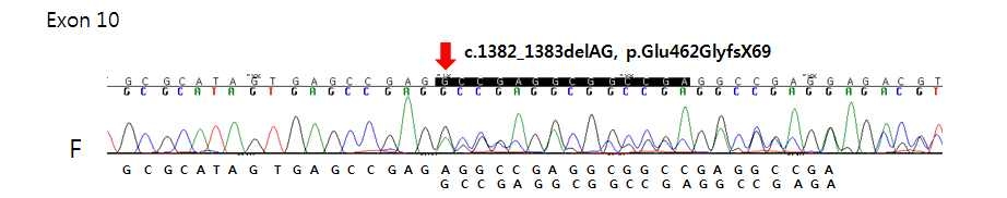 MEN1 유전자에서 새롭게 발견된 germline mutation