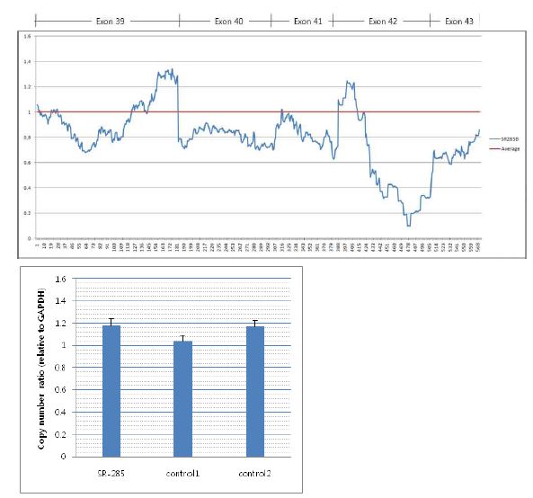 Real-time quantitative PCR analysis of exon 42 of MYO15A.