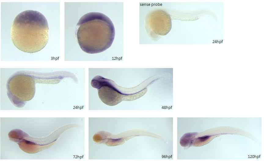 ANKFY1 expression during zebrafish development