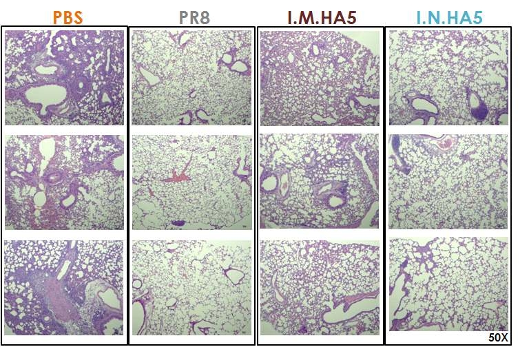 HA5의 I.N. 면역 후, A/Puerto Rico/8/1934(PR8, H1N1) 감염에 대한 폐조직 병변 분석 결과