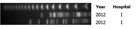 PFGE patterns of Xba-I digested DNA of the KPC-producing C. freundii