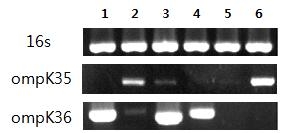 Expression of ompK35 and ompK36 in K. pneumonoae using RT-PCR