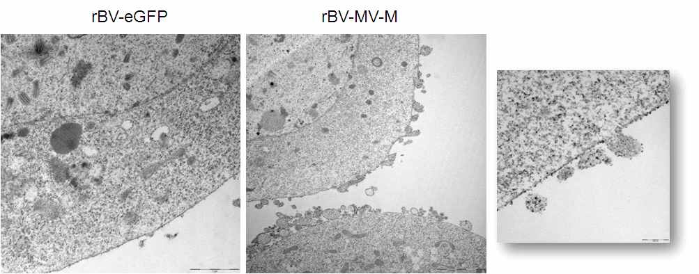 Measles matrix에 의한 VLP 형성되는 곤충세포를 TEM으로 관찰.