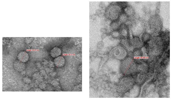 measles matrix 기반 VLP particle의 TEM 전자 현미경 사진