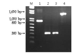 Triple-joining PCR for amplification of ermB, Left arm, Right arm, amy::ermB construct.