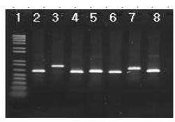 M. abscessus complex의 MLST 전기영동사진