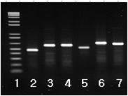 M. intracellulare의 MLST 전기영동사진