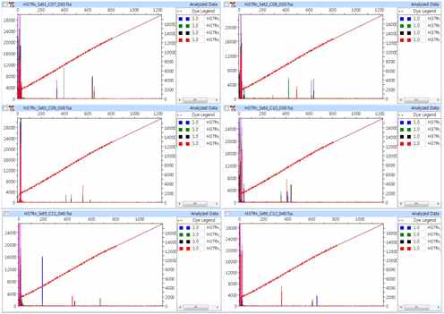 M. tuberculosis H37Rv ATCC 27294의 amplification plot