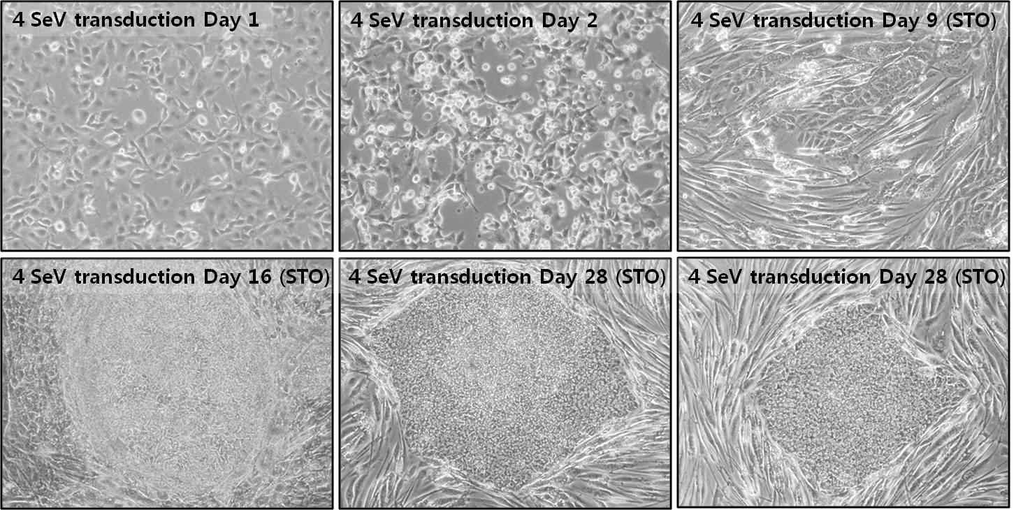 그림 2> Sendai virus를 이용해 확립한 CiMS-iPSC1