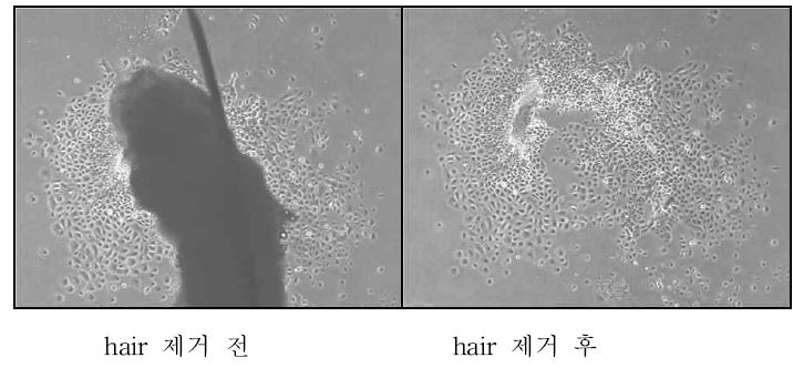 그림 2> 인체 두피조직 모근에서 뻗어나온 각질형성세포