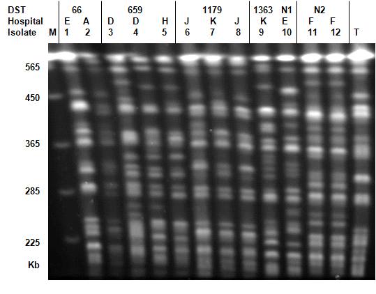 Figure 1. Representative PFGE patterns of C. albicans obtained by restrictionendonuclease analysis of genomic DNA using BssHII (REAG-B).