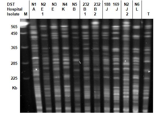 Figure 3. Restriction endonuclease analysis of genomic DNA using BssHI I followed by PFGE for azole resistant clinical isolates of C. tropicalis from six hospitals