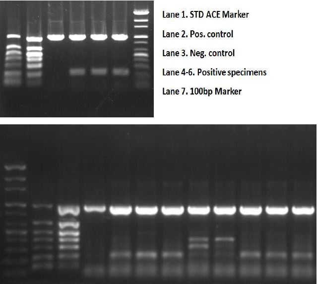 Fig. 2. Multiplex PCR for six urogenital pathogens including Neisseria gonorrhoeae