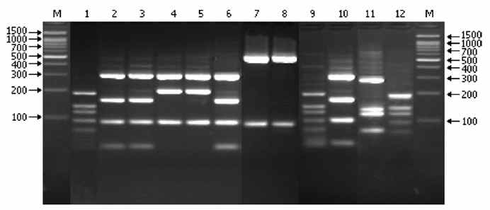 표준주 보렐리아 FlaB 유전자의 HpyF3I 제한효소 patterns