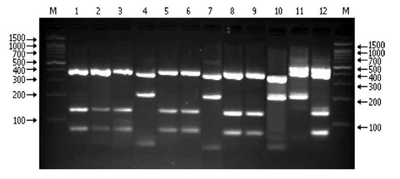 증폭된 표준주 보렐리아 FlaB 유전자의 HpyF3I 제한효소