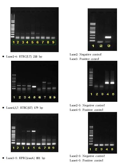 그림 28. Conventional PCR 에서 EPEC(eaeA)와 ETEC(ST, LT)의 결과